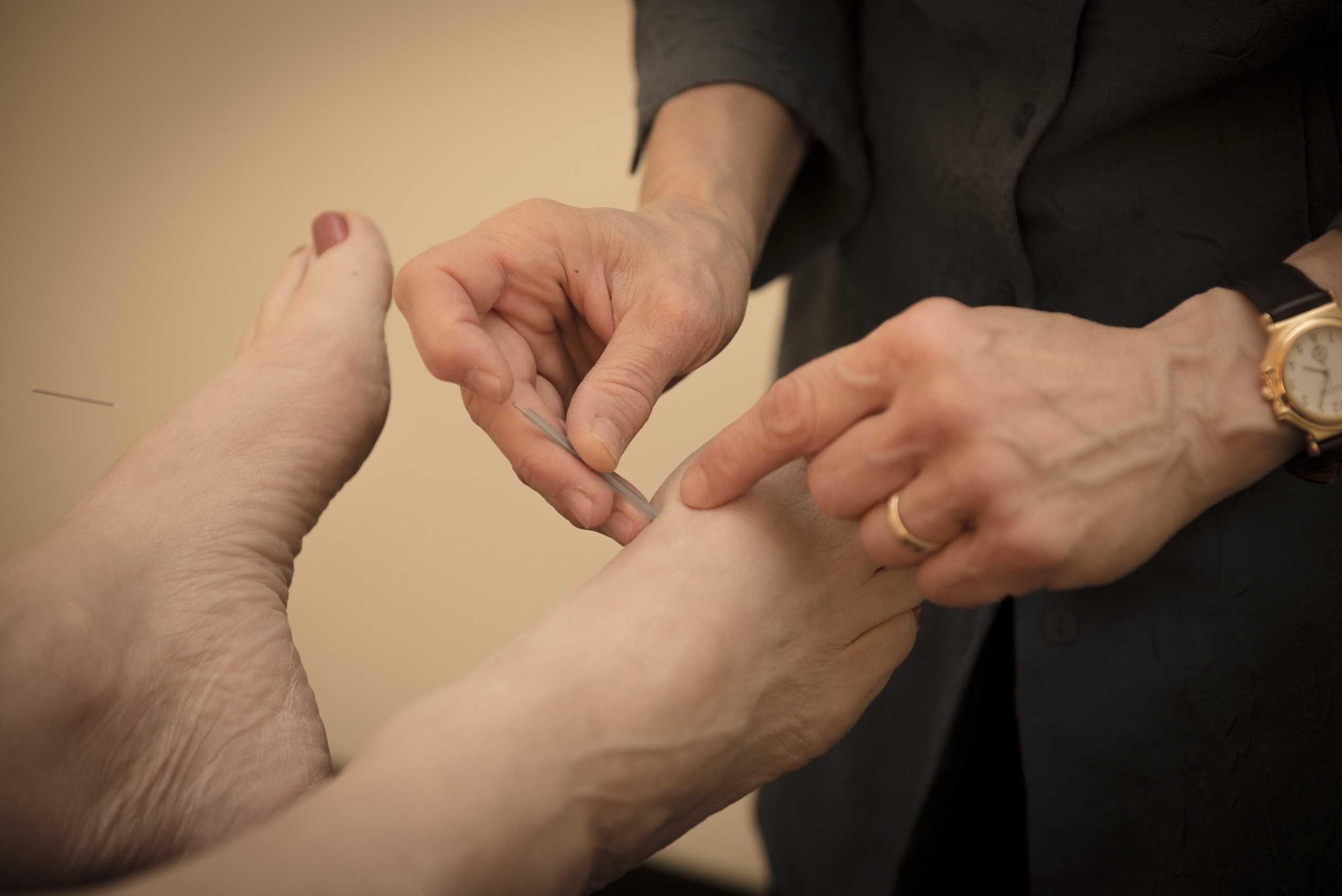 Treatable Conditions Cosmetic Acupuncture in Louisville, KY