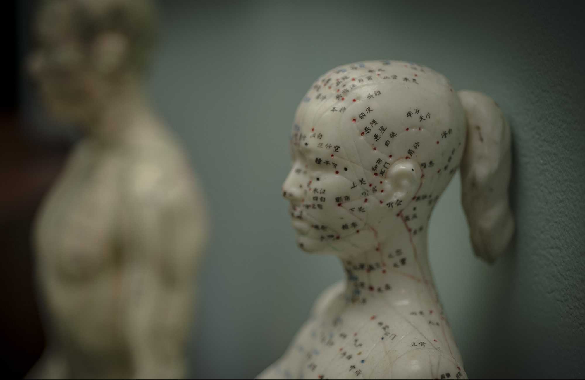 Acupuncture Treatments For Pain & Infertility in Louisville KY