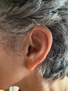 Ear Needles and Auriculotherapy at Classical Acupuncture & Herbs