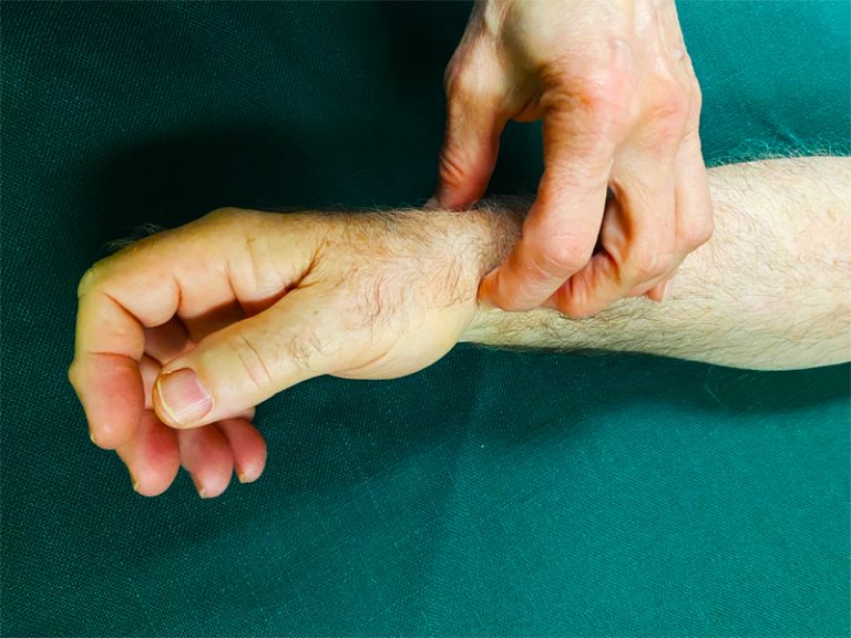 Treatment Chinese Medicine in Louisville Classical Acupuncture & Herbs