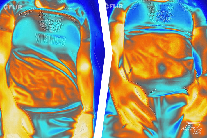 Thermography images showing a woman's health before and after treatment, indicating changes in temperature or blood flow