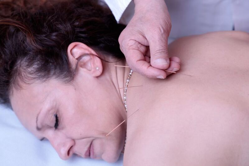 A woman receiving her first acupuncture session.